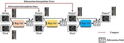 Progressive 3D biomedical image registration network based on deep self-calibration